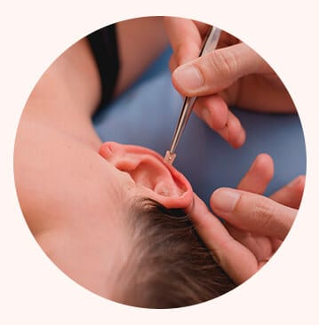 Tratamento de Auriculoterapia em Joinville