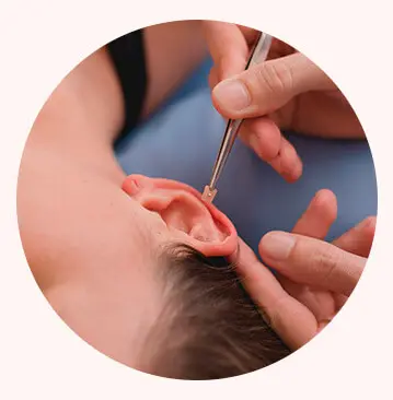 Tratamento de Auriculoterapia em Joinville